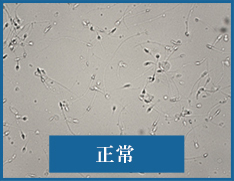 精子が乏精子状